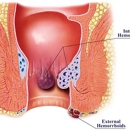 Colonoscopy & Endoscopy Center - Medical Centers