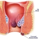 Colonoscopy & Endoscopy Center