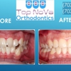 Top Nova Orthodontics gallery