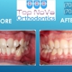 Top Nova Orthodontics