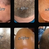 The Artist's Touch Permanent Makeup And Micropigmentation gallery