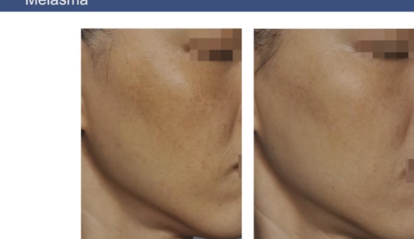 Clean Laser Clinics - Teneriffe, QLD