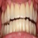 Fox Chapel Advanced Dental Care - Teeth Whitening Products & Services