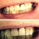 Adler Dental - Dentists