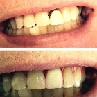 Adler Dental