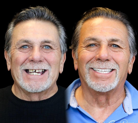 Smile Now Denver Dentures and Implants - Westminster, CO