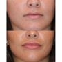 Destin Botox Laser and Facial Esthetics
