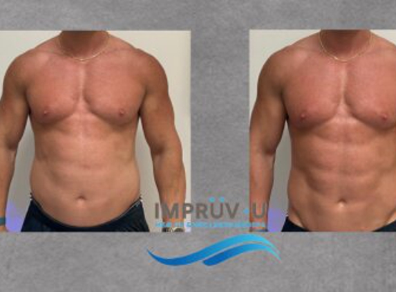 Impruv-U Health & Wellness Medspa - Boca Raton, FL