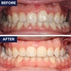Dentist of West Covina gallery