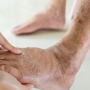 Proactive Podiatry