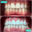 iSmile Spas - Cosmetic Dentistry