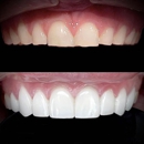 RR Smiles - Implant Dentistry