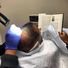 Neograft Hair Restoration Orange County