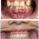 Rai Family Dentistry - Dental Hygienists