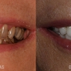 William P. Lamas, DMD - Periodontics & Dental Implants gallery