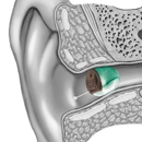 Audiology Services Inc - Hearing Aids-Parts & Repairing