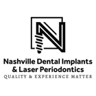 Nashville Dental Implants