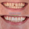 Innovative Smiles gallery