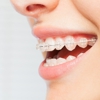 Precision Smile Orthodontics gallery