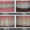 Aaron Birch Family Dental gallery