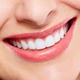 Smart Arches Dental Implants