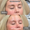 Liv Med Spa | Sioux Falls, SD gallery