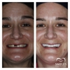 Mercer Smiles Family Dentistry Implant, Oral Surgery, and Cosmetic Dentist gallery