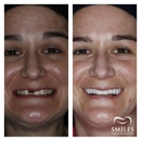 Mercer Smiles Family Dentistry Implant, Oral Surgery, and Cosmetic Dentist - Cosmetic Dentistry