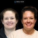 Smile Now Tacoma Dentures and Implants - Dentists