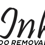 Uninked Laser Tattoo Removal
