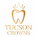 Tucson Crowns - Dentists