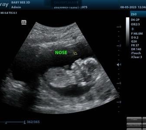 (Arlington) Baby Bee 3D Ultrasound + Studio - Arlington, TX