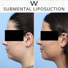 Wise Center for Plastic Surgery - Dr. Jeffrey B. Wise, MD, FACS NJ