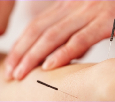 Jordan Health Clinic & Day Spa - Deland, FL. Acupuncture