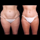 Metropolitan Plastic Surgery