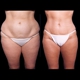 Metropolitan Plastic Surgery