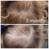 Hair Loss Solutions gallery