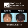 NYC Hair Restoration gallery