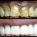 Caliber Dental - Dentists
