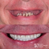 Florida Dental Implant Studio gallery