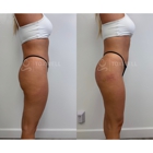 Toxwell Med Spa and Wellness