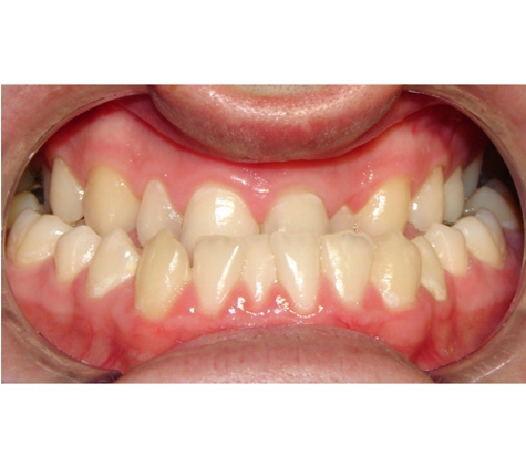Active Orthodontics - Pialba, QLD