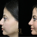 Beverly Hills Rhinoplasty Center: Deepak Dugar, MD - Physicians & Surgeons, Oral Surgery