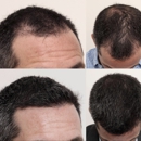 The Hair Loss Doctors - Surgery Centers