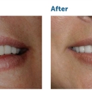DuPage Dental Smiles - Implant Dentistry