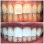 Organically White Teeth Whitening