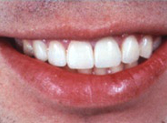 Murray Bruckel DDS - Norwalk, CT