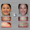 Roos Orthodontics gallery