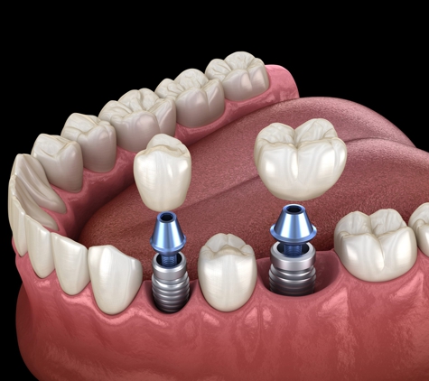 Williams Landing Dental Clinic - Williams Landing, VIC
