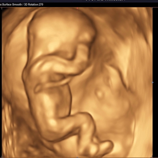 Womb's View - Modesto, CA. 14 weeks
